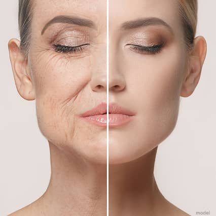 anti aging facial-la-bella-esthetics