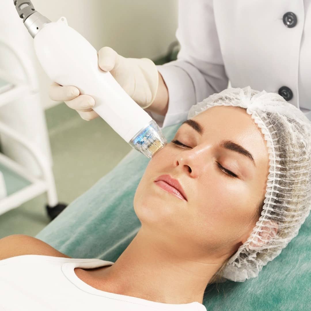 Fractional Radiofrequency Fairfax VA