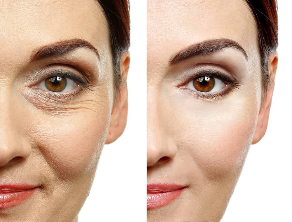 anti-aging-facial-fairfax VA