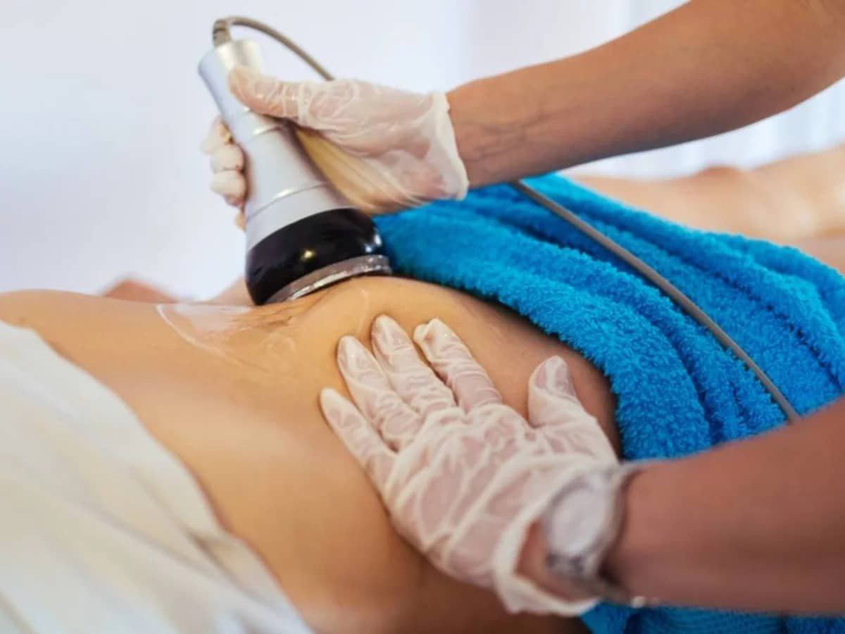 esthetics cavitation-fairfax VA